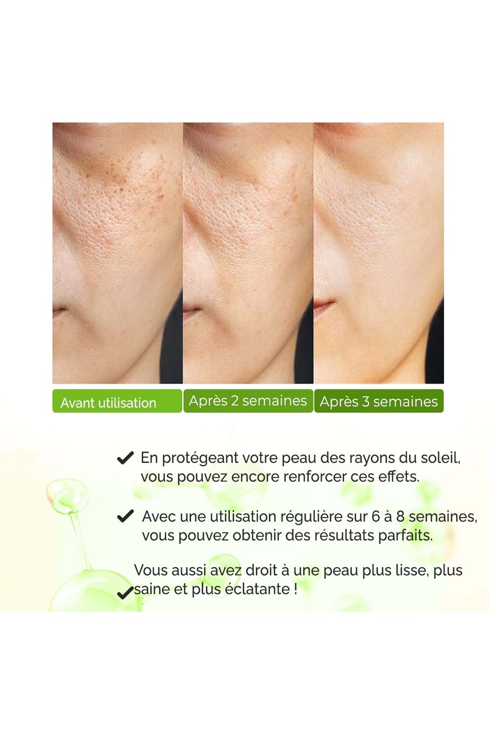 Sérum Purifiant Anti-Points Noirs & Anti-Acné, Resserrant De Pores – Vivo Series A210