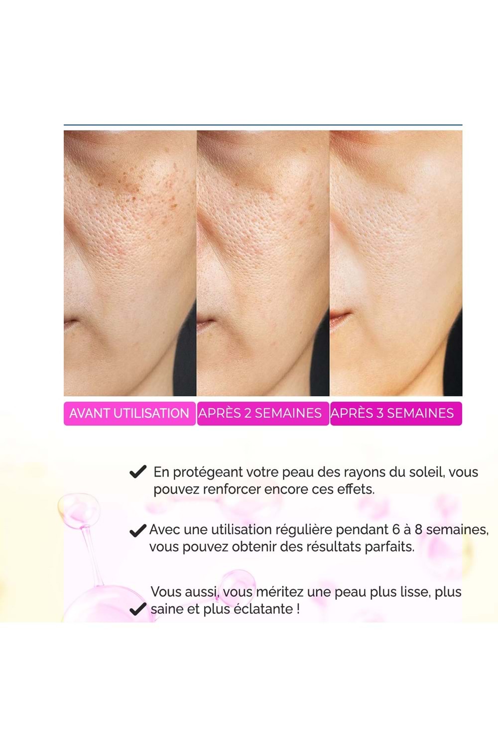 Sérum Anti-Acné, Anti-Points Noirs, Purifiant – Elixir Series A260