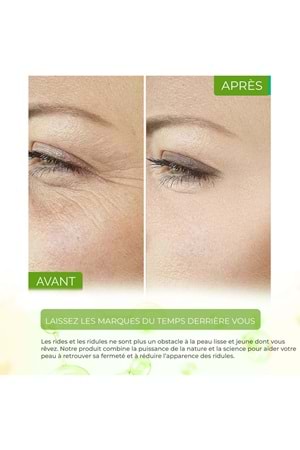 Sérum Purifiant Anti-Points Noirs & Anti-Acné, Resserrant De Pores – Vivo Series A210