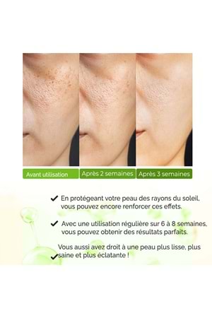 Sérum Purifiant Anti-Points Noirs & Anti-Acné, Resserrant De Pores – Vivo Series A210