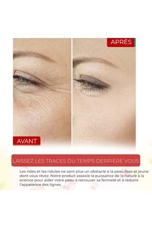 Sérum Premium Au Rétinol, Anti-Rides & Anti-Âge, Illuminateur – Xella Series A220