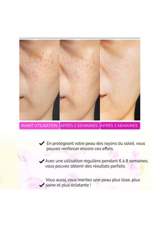 Sérum Anti-Acné, Anti-Points Noirs, Purifiant – Elixir Series A260