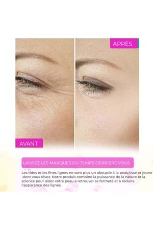 Sérum Anti-Acné, Anti-Points Noirs, Purifiant – Elixir Series A260